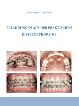 Abbildung von Londa | Erfahrungen aus der praktischen Kieferorthopädie | 1. Auflage | 2020 | beck-shop.de