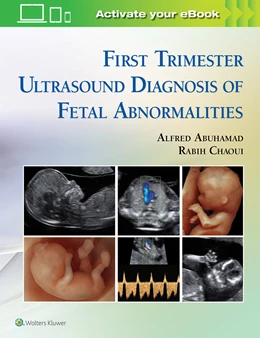 Abbildung von Abuhamad / Chaoui | First Trimester Ultrasound Diagnosis of Fetal Abnormalities | 1. Auflage | 2017 | beck-shop.de