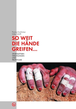 Abbildung von Hochholzer / Schöffl | So weit die Hände greifen... | 6. Auflage | 2014 | beck-shop.de