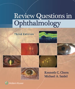 Abbildung von Chern / Saidel | Review Questions in Ophthalmology | 3. Auflage | 2015 | beck-shop.de