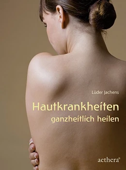 Abbildung von Jachens | Hautkrankheiten ganzheitlich heilen | 4. Auflage | 2015 | beck-shop.de
