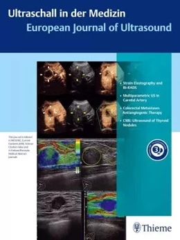 Abbildung von Ultraschall in der Medizin - European Journal of Ultrasound | 1. Auflage | 2024 | beck-shop.de