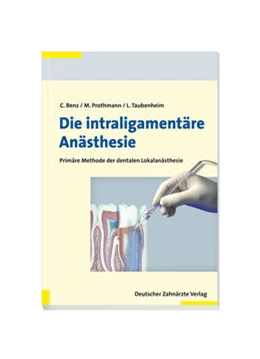 Abbildung von Benz / Prothmann | Die intraligamentäre Anästhesie | 1. Auflage | 2015 | beck-shop.de