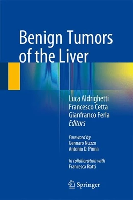 Abbildung von Aldrighetti / Cetta | Benign Tumors of the Liver | 1. Auflage | 2015 | beck-shop.de