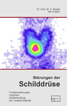 Abbildung von Bruker / Gutjahr | Störungen der Schilddrüse | 1. Auflage | 2004 | beck-shop.de