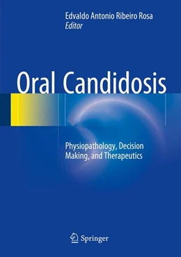 Abbildung von Ribeiro Rosa | Oral Candidosis | 1. Auflage | 2015 | beck-shop.de