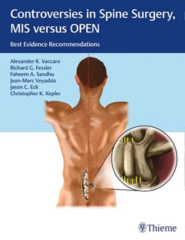 Abbildung von Vaccaro / Fessler | Controversies in Spine Surgery, MIS versus OPEN | 1. Auflage | 2018 | beck-shop.de