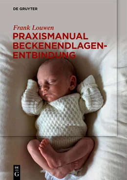 Abbildung von Louwen | Praxismanual Beckenendlagenentbindung | 1. Auflage | 2019 | beck-shop.de