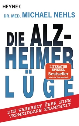 Abbildung von Nehls | Die Alzheimer-Lüge | 1. Auflage | 2017 | beck-shop.de