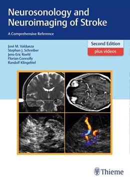 Abbildung von Valdueza / Schreiber | Neurosonology and Neuroimaging of Stroke | 2. Auflage | 2016 | beck-shop.de