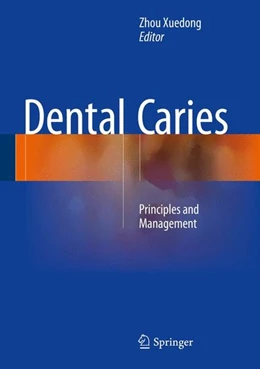 Abbildung von Xuedong | Dental Caries | 1. Auflage | 2015 | beck-shop.de