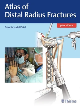 Abbildung von Del Pinal | Atlas of Distal Radius Fractures | 1. Auflage | 2018 | beck-shop.de