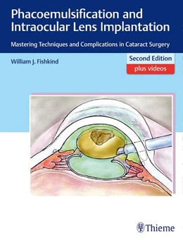 Abbildung von Fishkind | Phacoemulsification and Intraocular Lens Implantation | 2. Auflage | 2017 | beck-shop.de