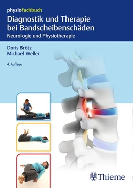 Abbildung von Brötz / Weller | Diagnostik und Therapie bei Bandscheibenschäden | 4. Auflage | 2017 | beck-shop.de