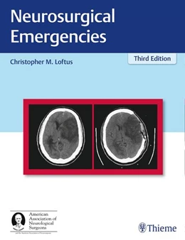 Abbildung von Loftus | Neurosurgical Emergencies | 3. Auflage | 2017 | beck-shop.de