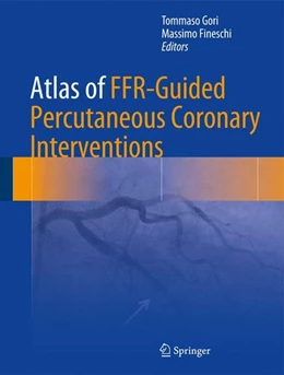 Abbildung von Gori / Fineschi | Atlas of FFR-Guided Percutaneous Coronary Interventions | 1. Auflage | 2017 | beck-shop.de