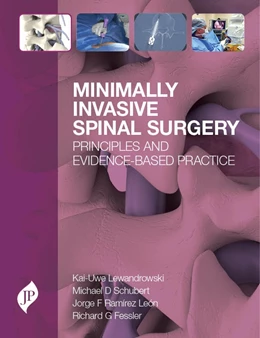 Abbildung von Lewandrowski / Schubert | Minimally Invasive Spinal Surgery | 1. Auflage | 2018 | beck-shop.de