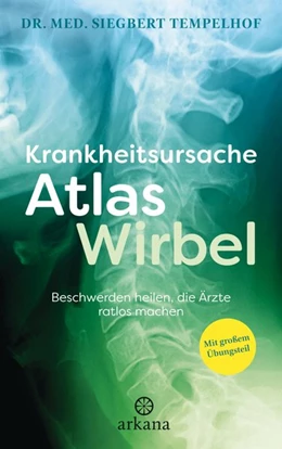 Abbildung von Tempelhof | Krankheitsursache Atlaswirbel | 1. Auflage | 2017 | beck-shop.de