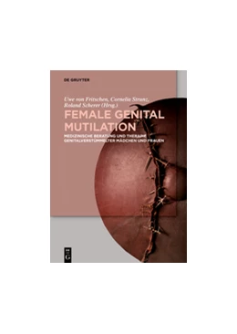 Abbildung von Fritschen / Strunz | Female Genital Mutilation | 1. Auflage | 2020 | beck-shop.de