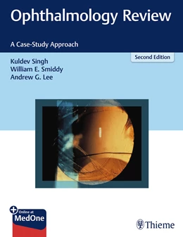 Abbildung von Singh / Smiddy | Ophthalmology Review | 2. Auflage | 2019 | beck-shop.de