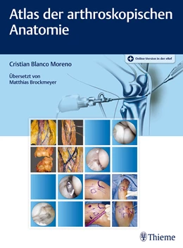 Abbildung von Blanco Moreno | Atlas der arthroskopischen Anatomie | 1. Auflage | 2017 | beck-shop.de