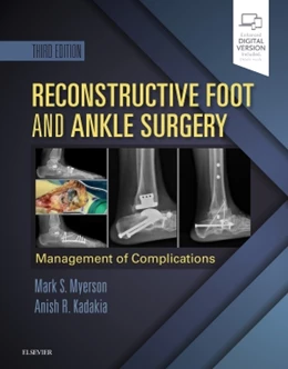 Abbildung von Myerson / Kadakia | Reconstructive Foot and Ankle Surgery: Management of Complications | 3. Auflage | 2018 | beck-shop.de