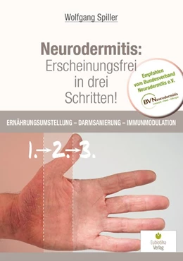 Abbildung von Wolfgang | Neurodermitis: Erscheinungsfrei in drei Schritten! | 1. Auflage | 2017 | beck-shop.de