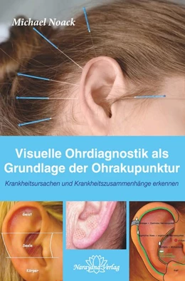 Abbildung von Noack | Visuelle Ohrdiagnostik als Grundlage der Ohrakupunktur | 1. Auflage | 2018 | beck-shop.de