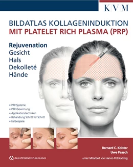 Abbildung von Paasch / Kolster | Bildatlas Kollageninduktion mit Platelet Rich Plasma (PRP) | 1. Auflage | 2018 | beck-shop.de