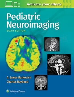 Abbildung von Barkovich | Pediatric Neuroimaging | 6. Auflage | 2018 | beck-shop.de