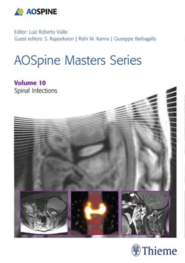 Abbildung von Rajasekaran / Kanna | Aospine Masters Series, Volume 10: Spinal Infections | 1. Auflage | 2018 | beck-shop.de
