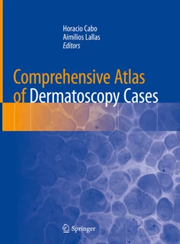 Abbildung von Cabo / Lallas | Comprehensive Atlas of Dermatoscopy Cases | 1. Auflage | 2018 | beck-shop.de