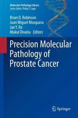 Abbildung von Robinson / Mosquera | Precision Molecular Pathology of Prostate Cancer | 1. Auflage | 2018 | beck-shop.de