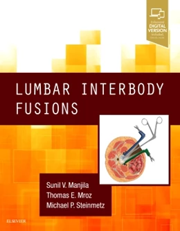 Abbildung von Manjila / Mroz | Lumbar Interbody Fusions | 1. Auflage | 2018 | beck-shop.de