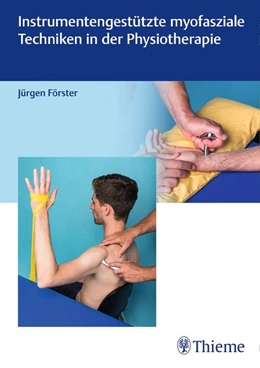 Abbildung von Förster | Instrumentengestützte myofasziale Techniken in der Physiotherapie | 1. Auflage | 2018 | beck-shop.de