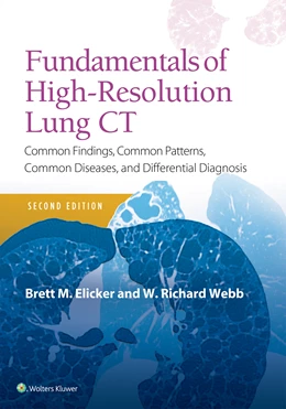 Abbildung von Elicker / Webb | Fundamentals of High-Resolution Lung CT | 2. Auflage | 2018 | beck-shop.de