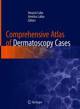 Abbildung von Cabo / Lallas | Comprehensive Atlas of Dermatoscopy Cases | 1. Auflage | 2018 | beck-shop.de