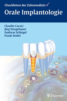 Abbildung von Cacaci / Neugebauer | Orale Implantologie | 1. Auflage | 2006 | beck-shop.de