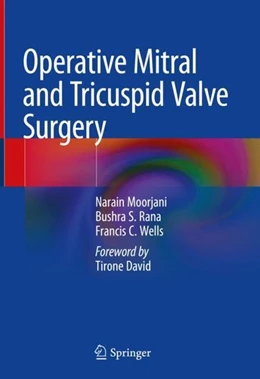 Abbildung von Moorjani / Rana | Operative Mitral and Tricuspid Valve Surgery | 1. Auflage | 2019 | beck-shop.de