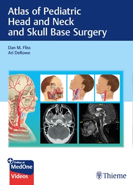 Abbildung von Fliss / DeRowe | Atlas of Pediatric Head and Neck and Skull Base Surgery | 1. Auflage | 2020 | beck-shop.de