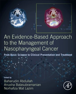 Abbildung von Abdullah / Balasubramanian | An Evidence-Based Approach to the Management of Nasopharyngeal Cancer | 1. Auflage | 2020 | beck-shop.de