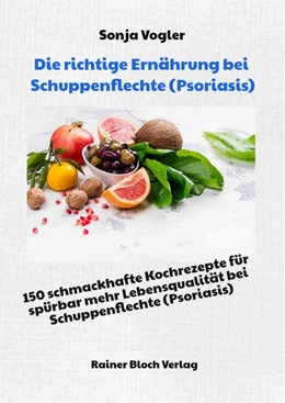 Abbildung von Vogler | Die richtige Ernährung bei Schuppenflechte (Psoriasis) | 1. Auflage | 2020 | beck-shop.de