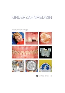Abbildung von Kühnisch | Kinderzahnmedizin | 1. Auflage | 2020 | beck-shop.de