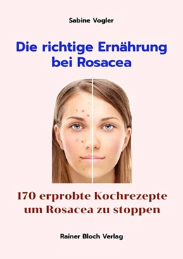 Abbildung von Vogler | Die richtige Ernährung bei Rosacea | 1. Auflage | 2020 | beck-shop.de