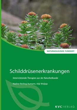 Abbildung von Berling-Aumann / Widjaja | Schilddrüsenerkrankungen | 1. Auflage | 2020 | beck-shop.de