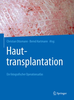 Abbildung von Ottomann / Hartmann | Hauttransplantation | 1. Auflage | 2023 | beck-shop.de