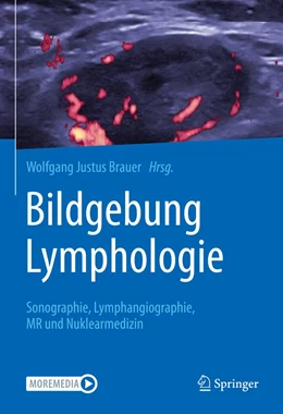 Abbildung von Brauer | Bildgebung Lymphologie | 1. Auflage | 2021 | beck-shop.de