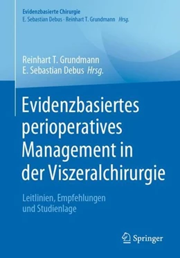 Abbildung von Grundmann / Debus | Evidenzbasiertes perioperatives Management in der Viszeralchirurgie | 1. Auflage | 2021 | beck-shop.de