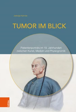 Abbildung von Kamola | Tumor im Blick | 1. Auflage | 2018 | beck-shop.de