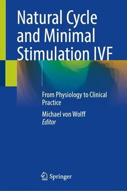 Abbildung von Wolff | Natural Cycle and Minimal Stimulation IVF | 1. Auflage | 2022 | beck-shop.de